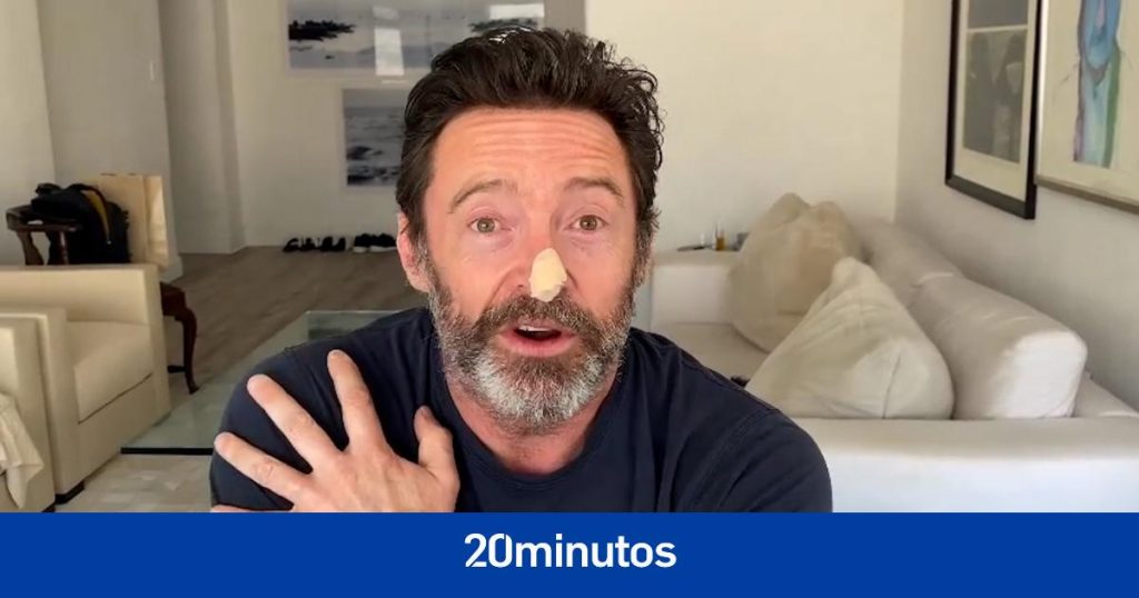 Hugh Jackman da negativo en dos biopsias ante el riesgo de cáncer de piel