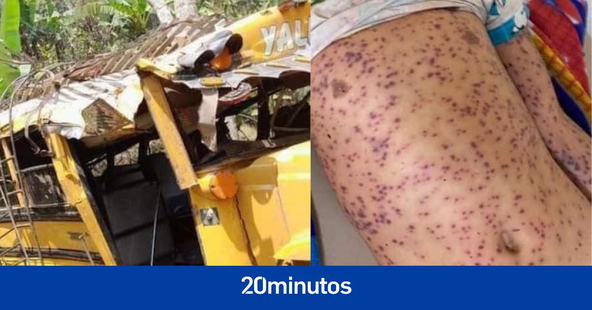 A FONDO | Las abejas africanizadas que están matando en Centroamérica A FONDO | Las abejas africanizadas que están matando en Centroamérica