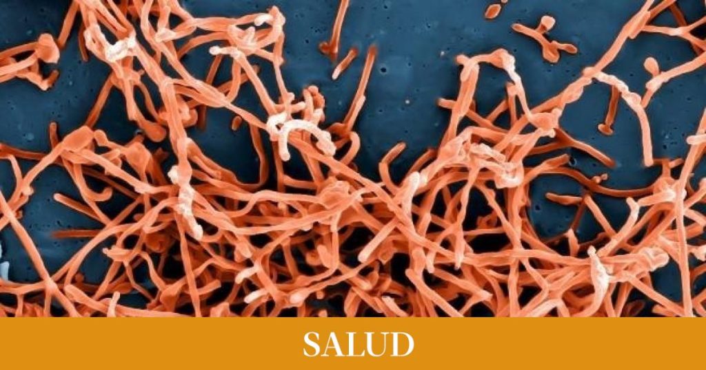 Estos son los síntomas, causas y tratamiento del ébola, una peligrosa enfermedad de la que se ha detectado un posible caso en Euskadi