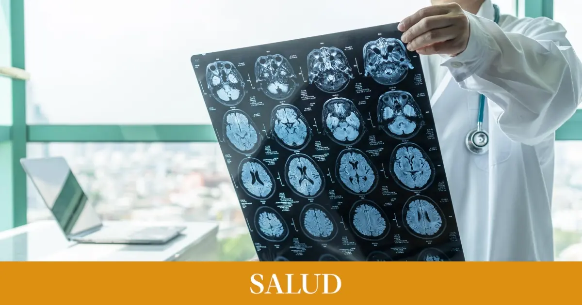 Hallan una nueva vacuna para prevenir el alzhéimer en personas con síndrome de Down