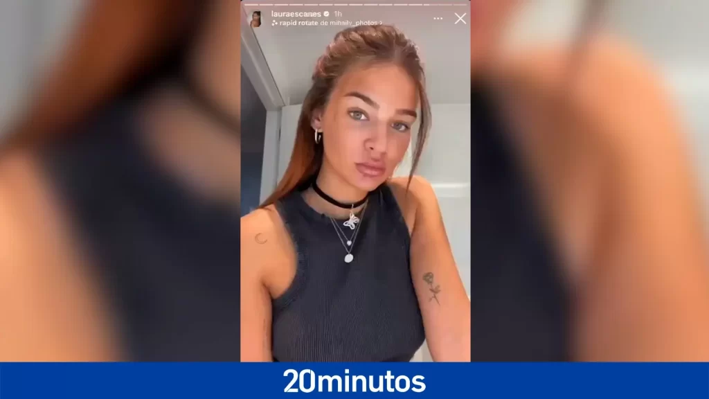 Laura Escanes responde con un ‘zasca’ a quienes la acusan de ponerse «demasiados labios»