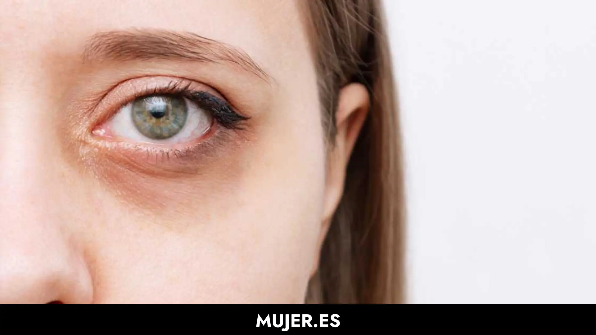 ¿Cómo eliminar las ojeras de forma efectiva? Aquí tienes siete soluciones probadas
