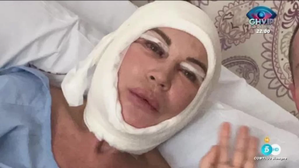 Marlene Mourreau, irreconocible tras operarse «la cara entera»: «Ahora parezco una momia» Marlene Mourreau, irreconocible tras operarse «la cara entera»: «Ahora parezco una momia»