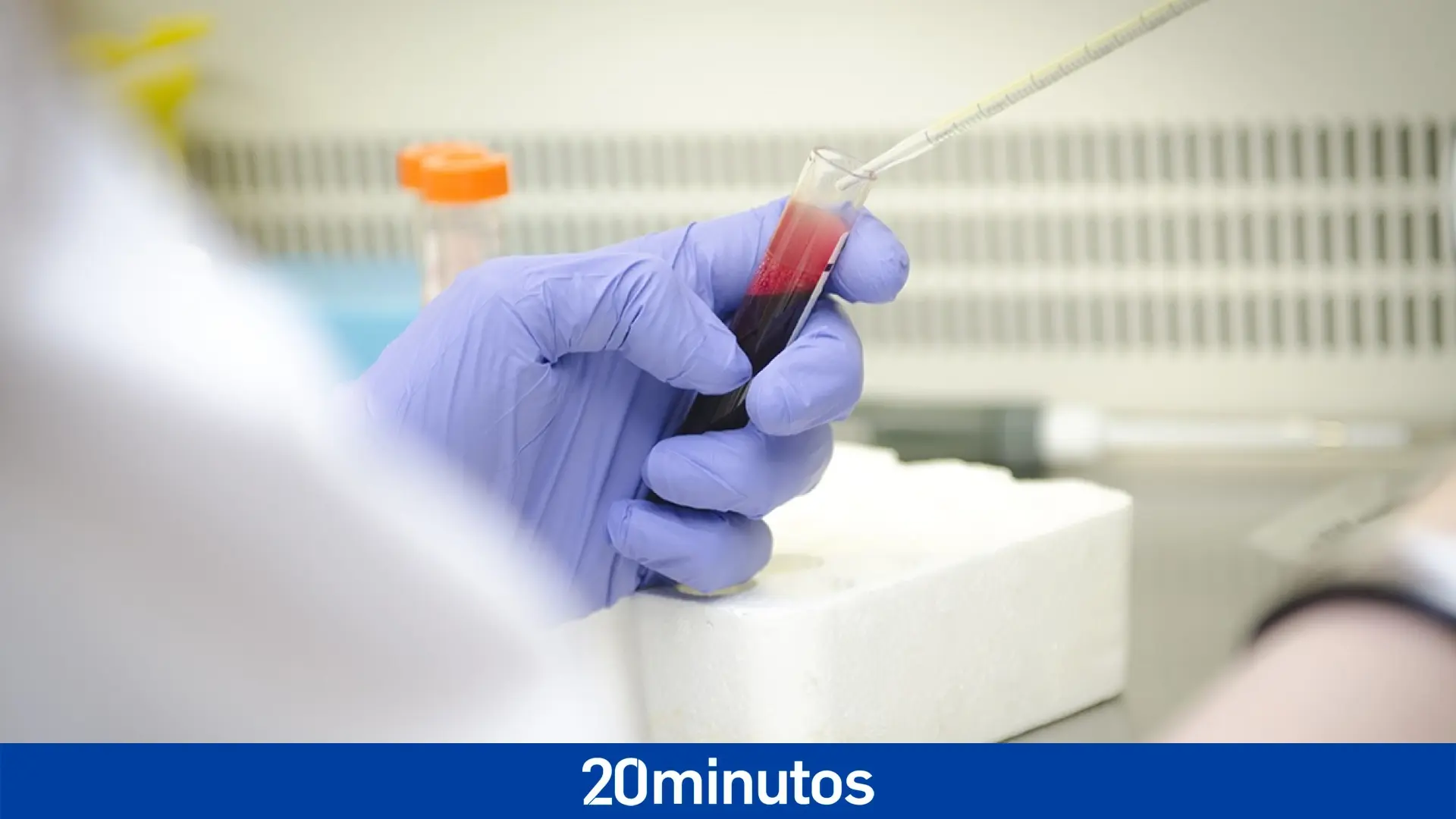 Un estudio revela cómo los anticuerpos frenan un virus humano que causa inflamación grave del corazón Un estudio revela cómo los anticuerpos frenan un virus humano que causa inflamación grave del corazón