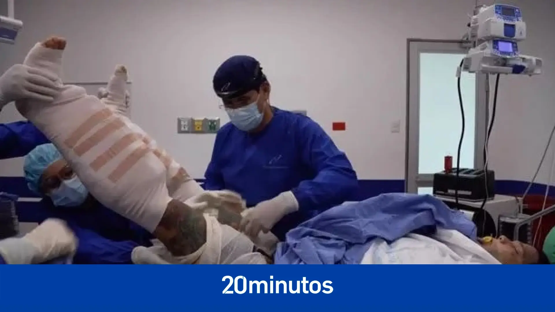 Un ‘influencer’ se somete a la «operación más dolorosa» para aumentar en 6 cm su estatura